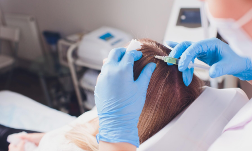 Hair Loss Specialist